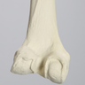 Femur with Arthritis, Foam Cortical, Left, Medium