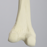 Femur, 10 Degree Distal Valgus Deformity, Foam Cortical, Left