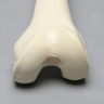 Femur, 11 mm Canal, Foam Cortical, Left, Medium