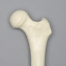 Femur, 11 mm Canal, Foam Cortical, Left, Medium