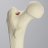 Femur for IM Nail with 15 mm, Foam Cortical, Left, Medium