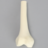 Femur, Distal with 15 mm Canal, Right