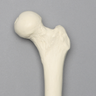 Femur, 9.5 mm Canal, Solid Foam, Left, Small