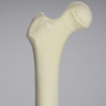 Femur, 15 mm Canal, Solid Foam, Right, Medium