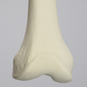 Femur, 15 mm Canal, Solid Foam, Right, Medium