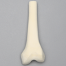 Femur, Distal with 15 mm Canal, Left