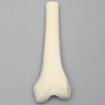 Femur, Distal with 15 mm Canal, Left