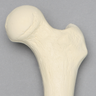 Femur, 15 mm Canal, Solid Foam, Left, Medium