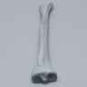 Tibia with Plugged Distal End and Radiopaque Properties, Left