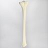 Tibia with Condylar Fracture and Fragment, Right, Medium