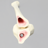 Tibia with 12 mm Canal, Oblique Fracture for IM Nail