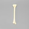 Tibia with 12 mm Canal, Oblique Fracture for IM Nail