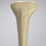 Tibia with Osteoporotic Cortex, Left, Medium