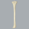 Tibia with Osteoporotic Cortex, Right, Medium