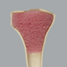 Tibia with Osteoporotic Cortex, Right, Medium