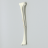 Tibia with Segmental Fracture, Solid Foam, Left, Medium