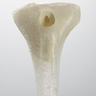 Tibia with 13 mm Entry Site for IM Nail, Left