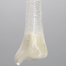 Tibia with 13 mm Entry Site for IM Nail, Left