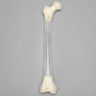 Femur, Transparent with 15.5 mm Canal, Right