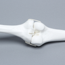 Knee Joint with Four Stretch Cord Ligaments