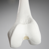 Femur with 12.5 mm Canal, Plastic Cortical Shell, Left