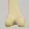 Femur with Narrow Intercondylar Notch, Foam Cortical Shell, Left