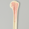 Humerus with 12 mm Proximal Canal, Foam Cortical