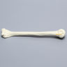 Humerus with Neck Fracture, Foam Cortical
