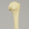 Humerus with Modified Cancellous Density, Foam Cortical