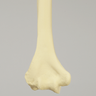 Humerus with Modified Cancellous Density, Foam Cortical