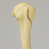Humerus with Three-Part Head Fracture, Foam Cortical