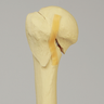 Humerus with Three-Part Head Fracture, Foam Cortical