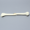 Humerus with Oblique Fracture, Foam Cortical