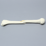 Humerus with Oblique Fracture, Foam Cortical
