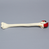 Humerus with Five-Part Head Fracture and Ligaments, Foam Cortical