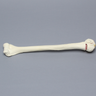 Humerus with Four-Part Bicipital Groove Fracture, Foam Cortical, Left