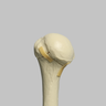 Humerus with Four-Part Bicipital Groove Fracture, Foam Cortical, Left