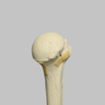 Humerus with Four-Part Bicipital Groove Fracture, Foam Cortical, Left