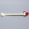 Humerus with Three-Part Head Fracture and Tendon, Foam Cortical