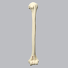 Humerus with Distal "T" Fracture, Foam Cortical
