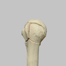 Humerus with Four-Part Head Fracture, Foam Cortical