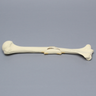 Humerus with Butterfly Fracture, Foam Cortical