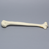 Humerus with "Y" Fracture, Foam Cortical