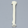 Radius with Fracture for Volar Plate, Foam Cortical