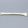 Radius with Fracture for Volar Plate, Foam Cortical