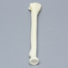 Radius with Four-Part Fracture, Foam Cortical