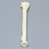 Radius with Four-Part Fracture, Foam Cortical
