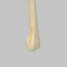 Radius with Three-Part Intra-Articular Fracture and Removed Tubercle, Foam Cortical