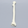 Radius, 5.5mm Canal, Foam Cortical Shell, Right