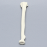 Radius, 5.5mm Canal, Foam Cortical Shell, Right